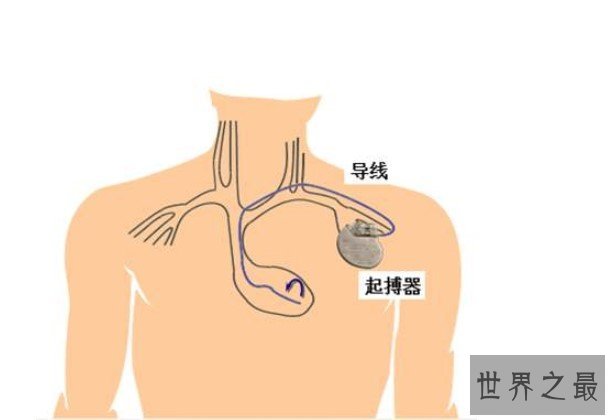 改变世界的十大意外发明（二），微波炉最为方便和实用