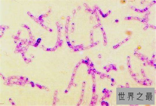 世界上最危险的10种细菌，梅毒高居榜首！