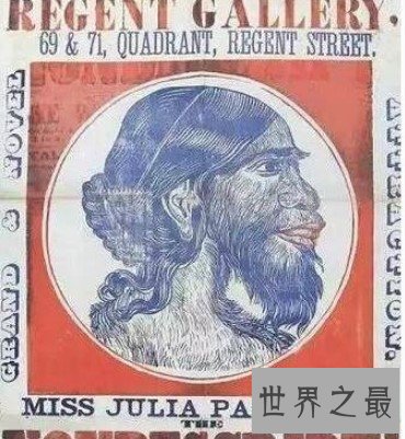 世界上最丑最悲哀的女人，长得像怪物被当做工具展览150年