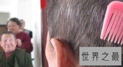 史上发育两次的老人，86岁后再次重新发育