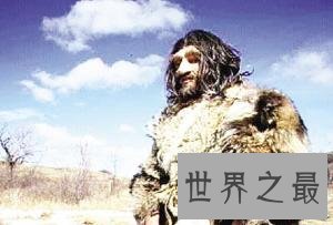 世界上唯一双目失明的民族，盲族(血液中尾线虫影响视觉)