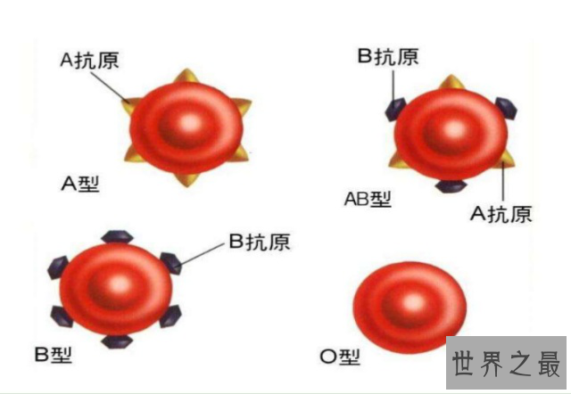 世界最罕见的血型，仅中国发现一例，世上再无出现