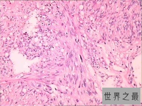 人体最大的器官是肝脏 最新发现的最大器官能分散癌症