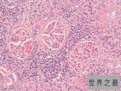 人体最大的器官是肝脏 最新发现的最大器官能分散癌症