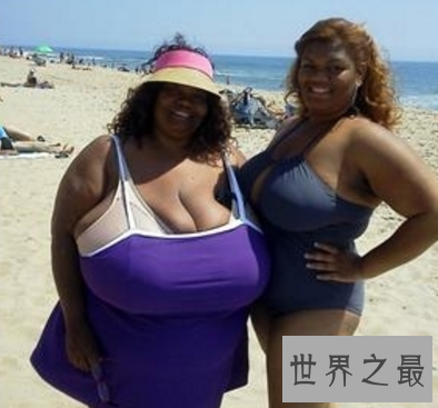 世界上最大的胸 双乳重达77斤真的有人喜欢吗