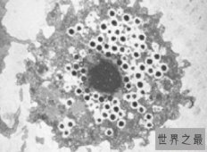 生存在海底1万米下的生物，巨型阿米巴虫