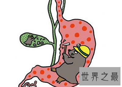 你得胆汁反流性胃炎了吗？最佳治疗方法告诉你