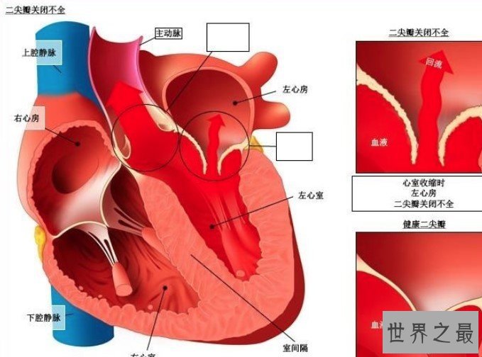 最强3D打印技术，首次制造“迷你人类心脏”