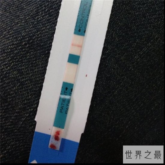 测癌试纸用来检测胰腺癌，价格低廉有效度惊人