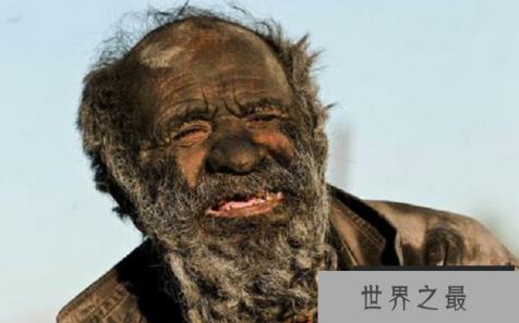 世界上最脏的人 60年从未洗过澡，只为留住妻子的味道