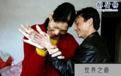 中国最高的女人是谁,姚德芬身高2.4米(脚长45.5厘米)