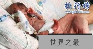 世界上最小的婴儿：体重仅200多克，小袋洗衣粉都比他重