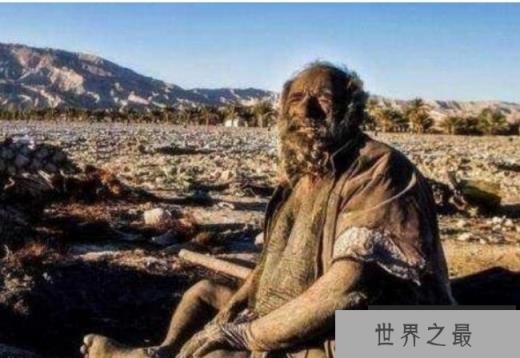 世界上最脏的人 8旬老汉60年不洗澡(身体像穿铠甲)