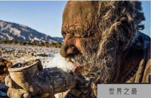 世界上最脏的人 8旬老汉60年不洗澡(身体像穿铠甲)