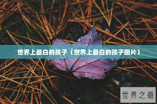 世界上最白的孩子（世界上最白的孩子图片）