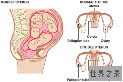 【图】双阴是什么意思 男子公开示意与双阴道女子性爱