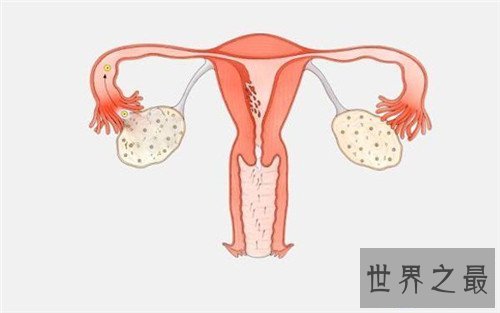 【图】生殖图女性结构引见 女性生殖器蕴含哪些局部