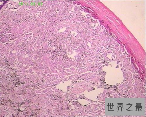 【图】一同来了解关于癌细胞的科普知识，让咱们更好