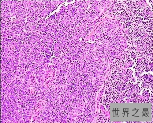 【图】一同来了解关于癌细胞的科普知识，让咱们更好