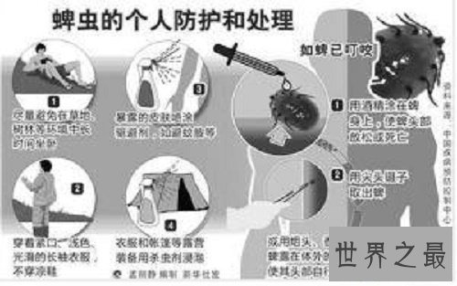 【图】蜱虫叮咬后的伤口图片，如何预防蜱虫