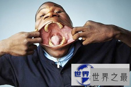 【图】世界上最大的嘴，嘴巴最大的人(宽17厘米)